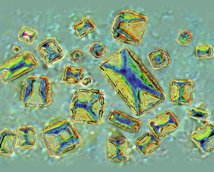 The kidney harbours a microbiota that may influence lithogenesis