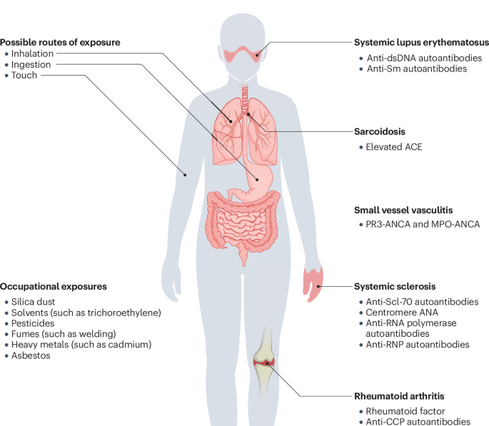 Occupational dust and chemical exposures and the development of autoimmune rheumatic diseases