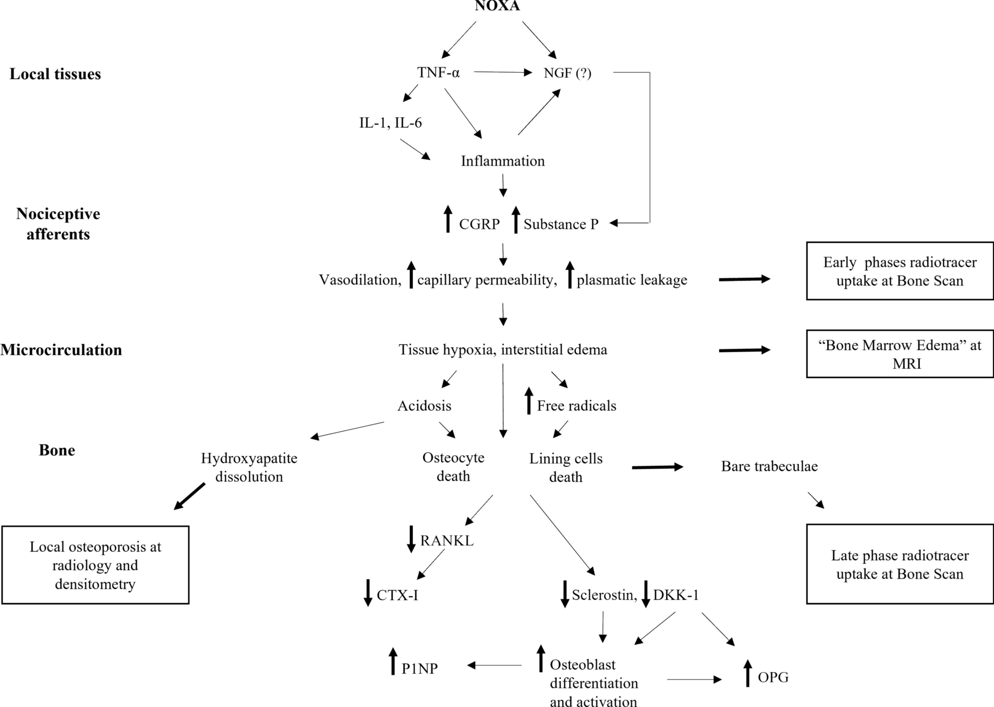 Osteoclast in CRPS: an alleged guilty fully acquitted
