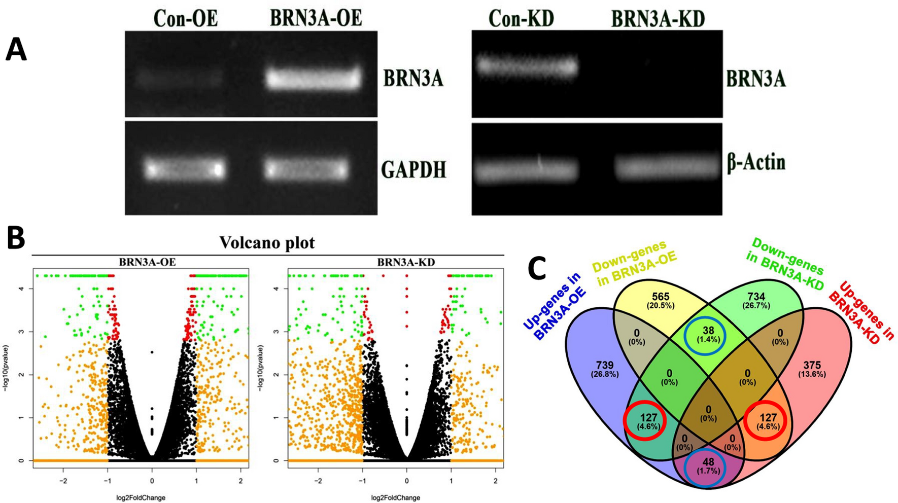 BRN3A, a transcription factor, regulates the expression of genes involved in biological processes shaping the HPV induced cervical cancer