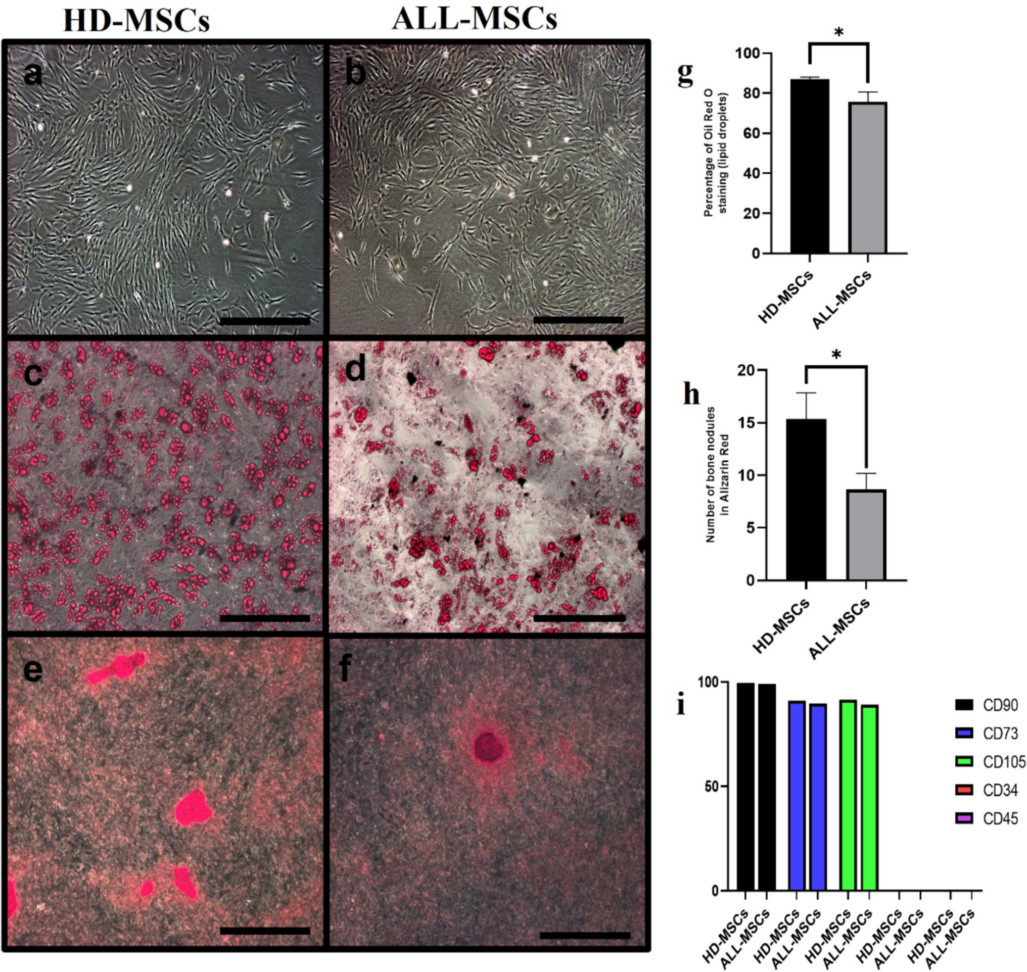 The dynamic interaction of pediatric ALL cells and MSCs: influencing leukemic cell survival and modulating MSC β-catenin expression