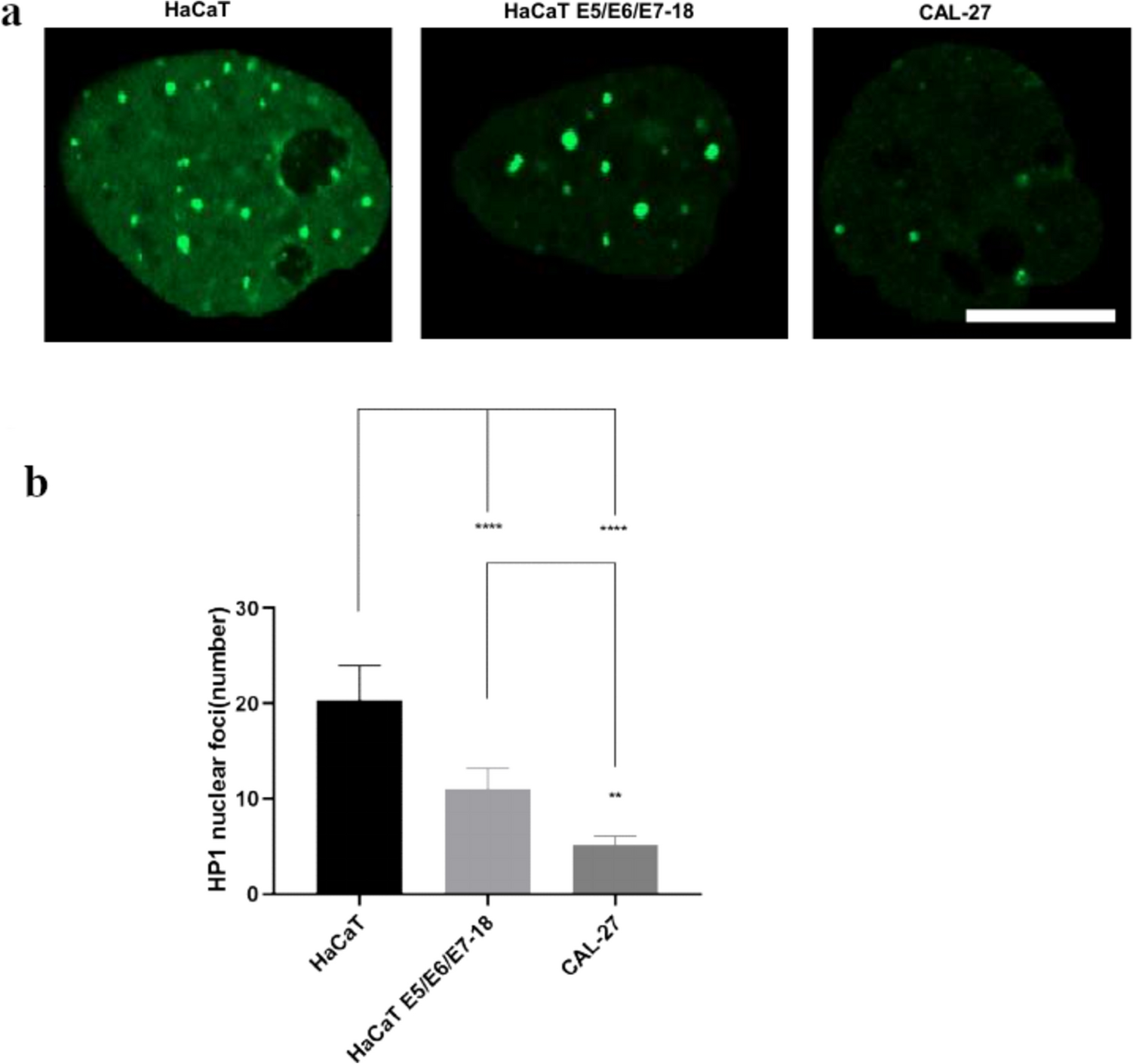 Differential cell architecture and microenvironmental responses of pretumoral and tumoral cellular models exposed to coverslip-induced hypoxia