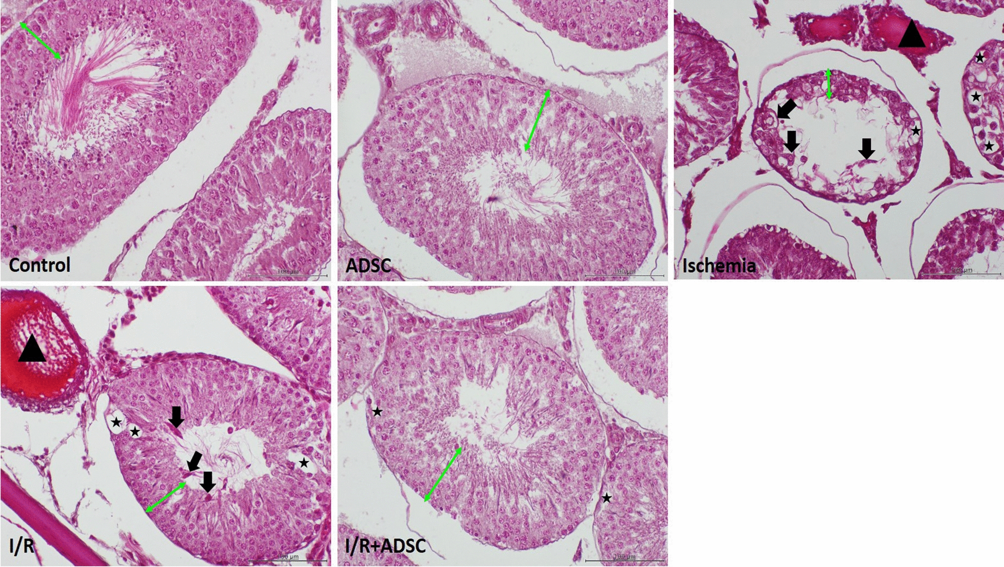 Protective effects of adipose-derived stem cells against testicular injury induced after ischemia–reperfusion by regulating autophagy