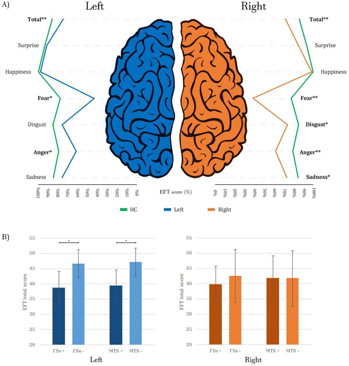 Exploring the role of epileptic focus lateralization on facial emotion recognition in the spectrum of mesial temporal lobe epilepsy
