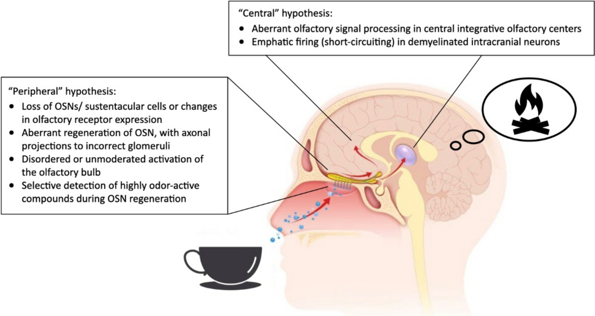 Parosmia: Pathophysiology and Management