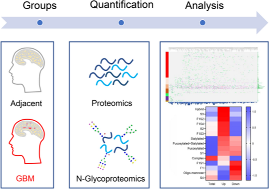 Integrated proteomics and N-glycoproteomic characterization of glioblastoma multiform revealed N-glycosylation heterogeneities as well as alterations in sialyation and fucosylation