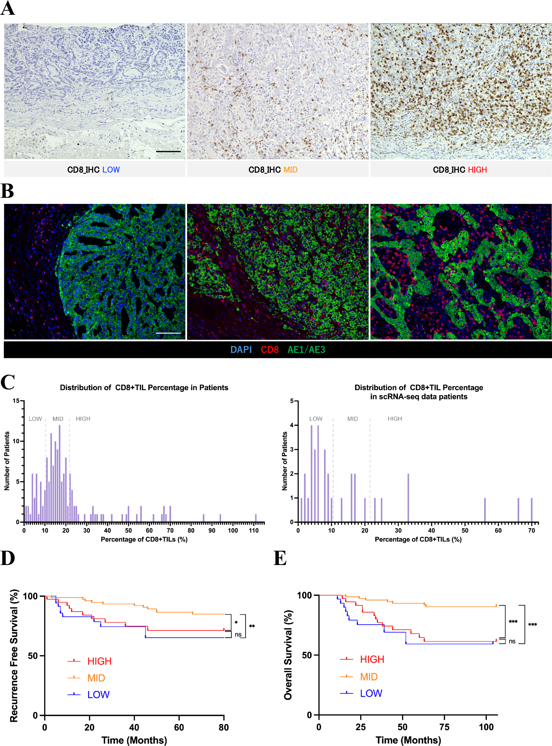 Tumor infiltration of inactive CD8 + T cells was associated with poor prognosis in Gastric Cancer