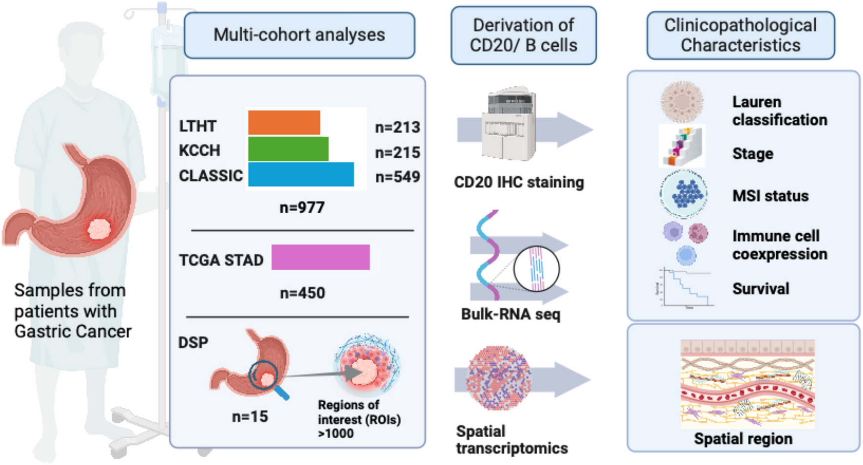 Spatial organization of B lymphocytes and prognosis prediction in patients with gastric cancer