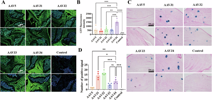 Co-delivery of IL-1Ra and SOX9 via AAV inhibits inflammation and promotes cartilage repair in surgically induced osteoarthritis animal models