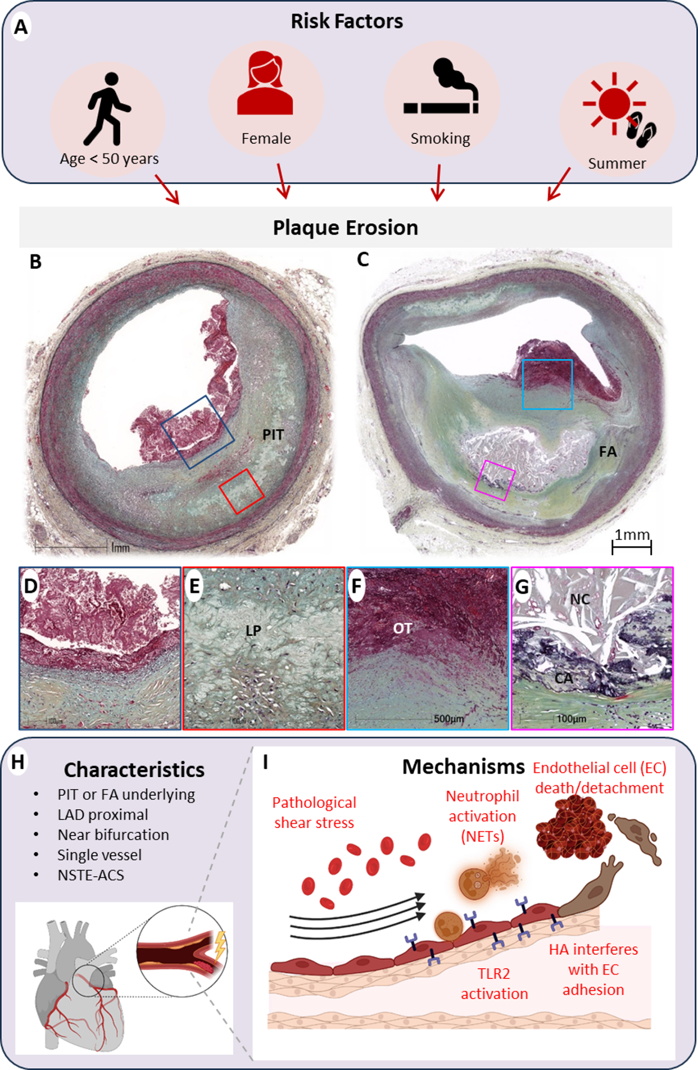 Risk Factors Favoring Plaque Erosion