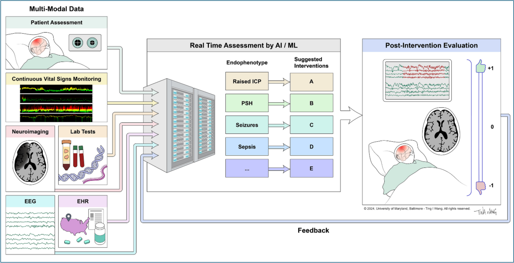 Machine Learning Approaches to Prognostication in Traumatic Brain Injury
