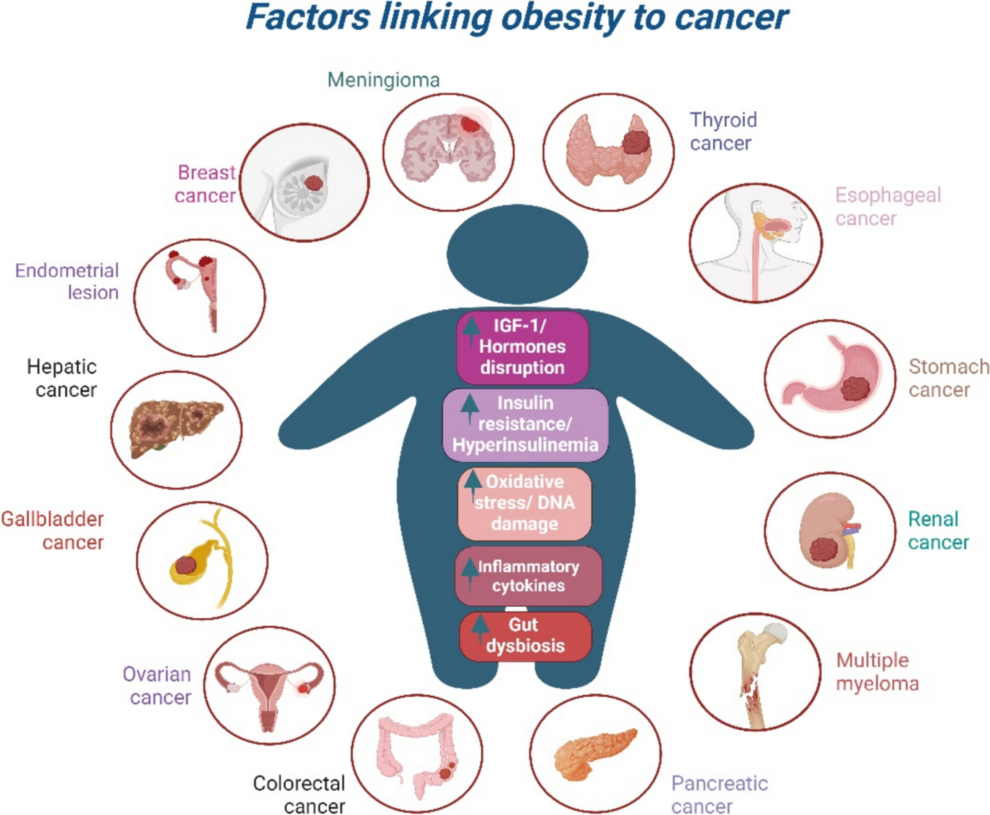 Beneath the Surface: The Emerging Role of Ultra-Processed Foods in Obesity-Related Cancer