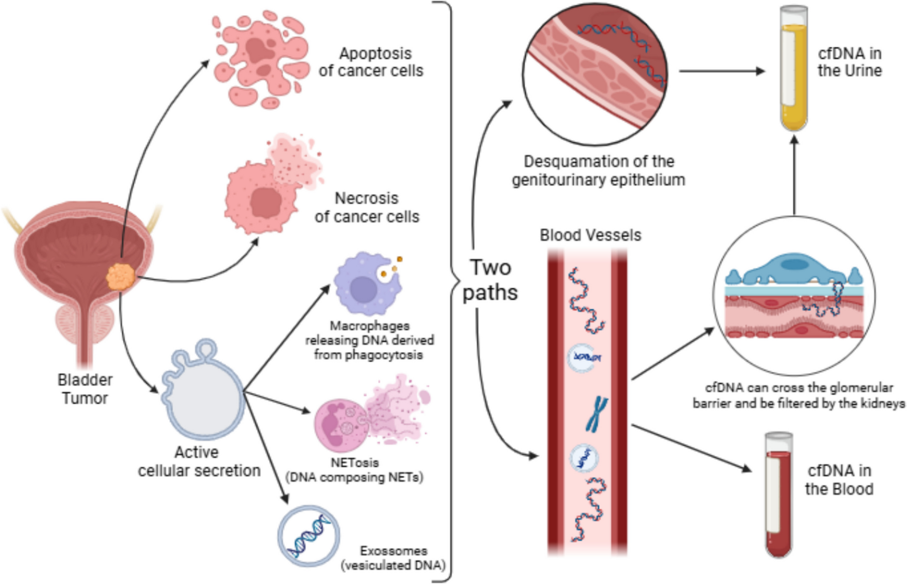 Cell-free Tumor DNA: a Promising Technology for Diagnosis, Surveillance and Therapeutic Decision in Urothelial Carcinoma of the Bladder