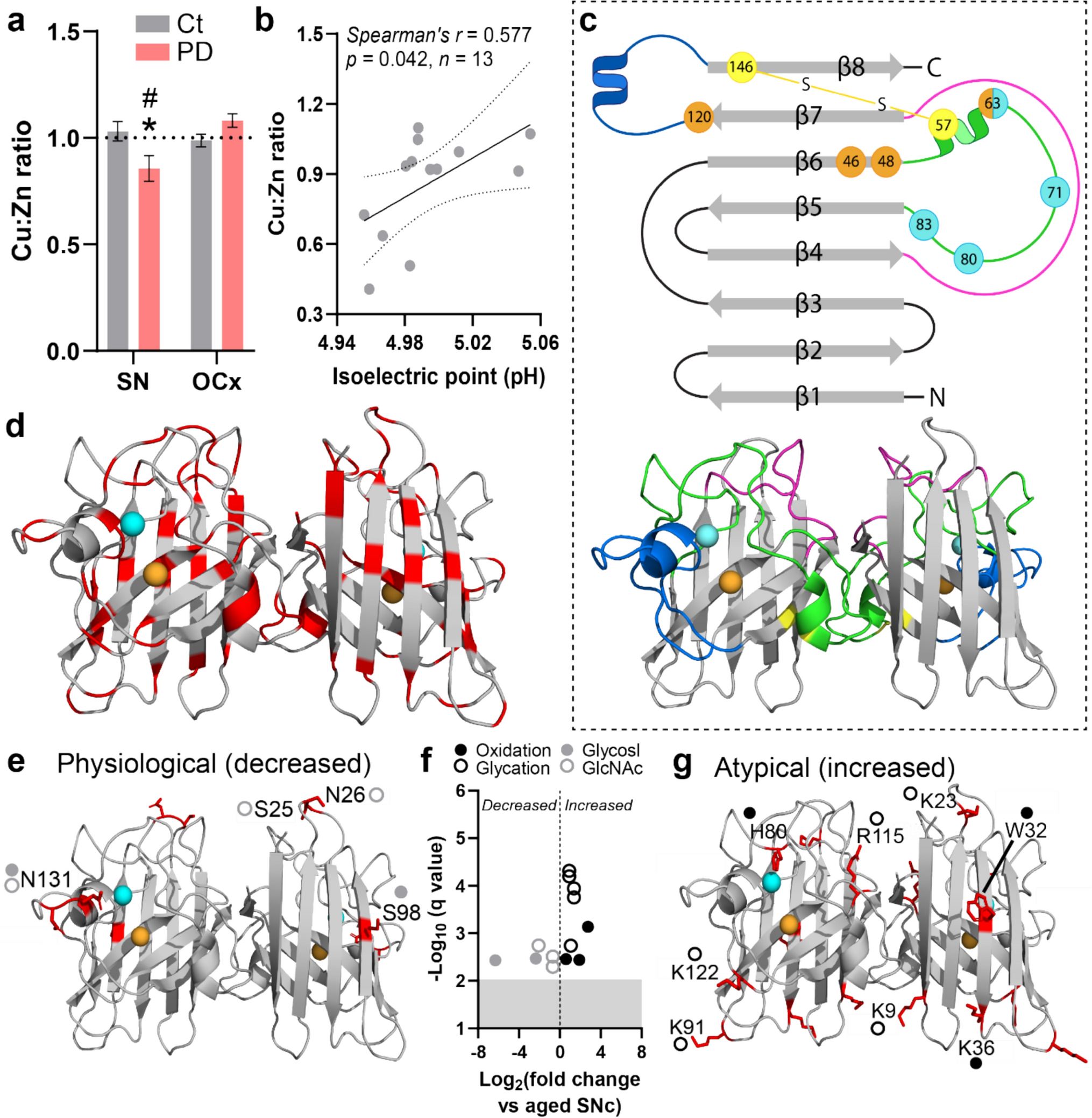 Parkinson-like wild-type superoxide dismutase 1 pathology induces nigral dopamine neuron degeneration in a novel murine model