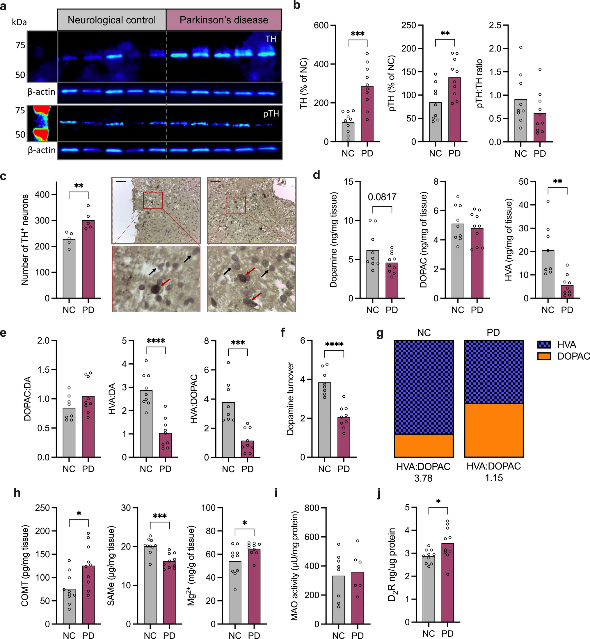 Evidence of COMT dysfunction in the olfactory bulb in Parkinson’s disease