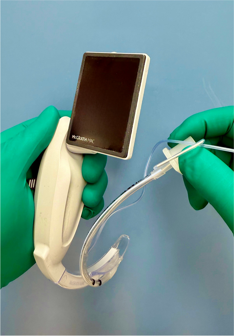 Appropriate shape of a stylet for tracheal intubation using the McGrath® MAC videolaryngoscope in neonates: a randomized crossover simulation study