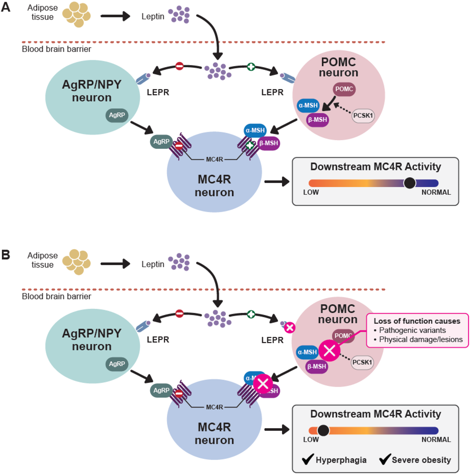 Defining Hyperphagia for Improved Diagnosis and Management of MC4R Pathway–Associated Disease: A Roundtable Summary