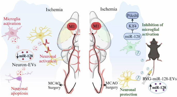 Aberrant neuronal excitation promotes neuroinflammation in the primary motor cortex of ischemic stroke mice