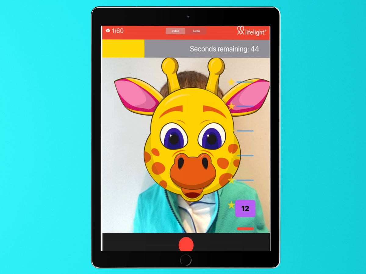 The Measurement of Vital Signs in Pediatric Patients by Lifelight Software in Comparison to the Standard of Care: Protocol for the VISION-Junior Observational Study
