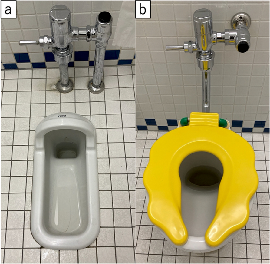 Are floating toes associated with lifestyle in children? A cross-sectional study