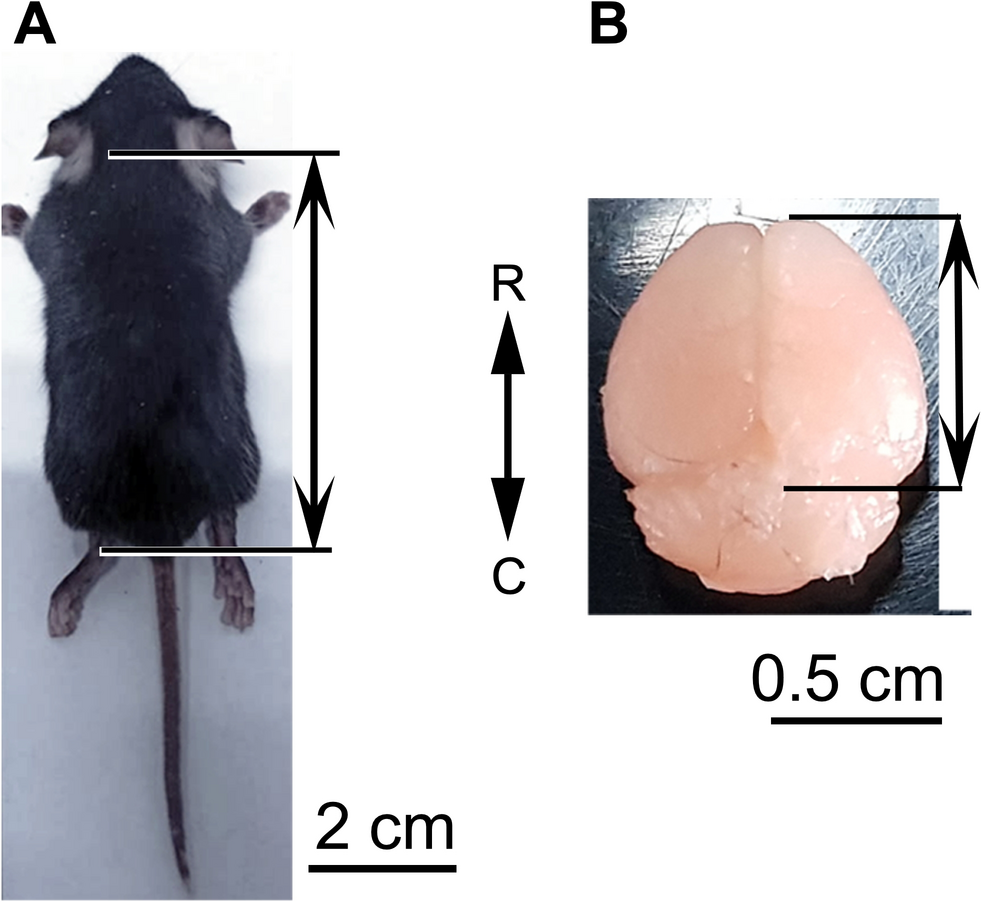 Prenatal protein deficiency causes age-specific alteration in number and distribution of inhibitory neurons in the somatosensory cortex during early postnatal development