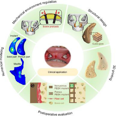 A design strategy for long-term stability of porous PEEK implants by regulation of porous structure and in vivo mechanical stimulation