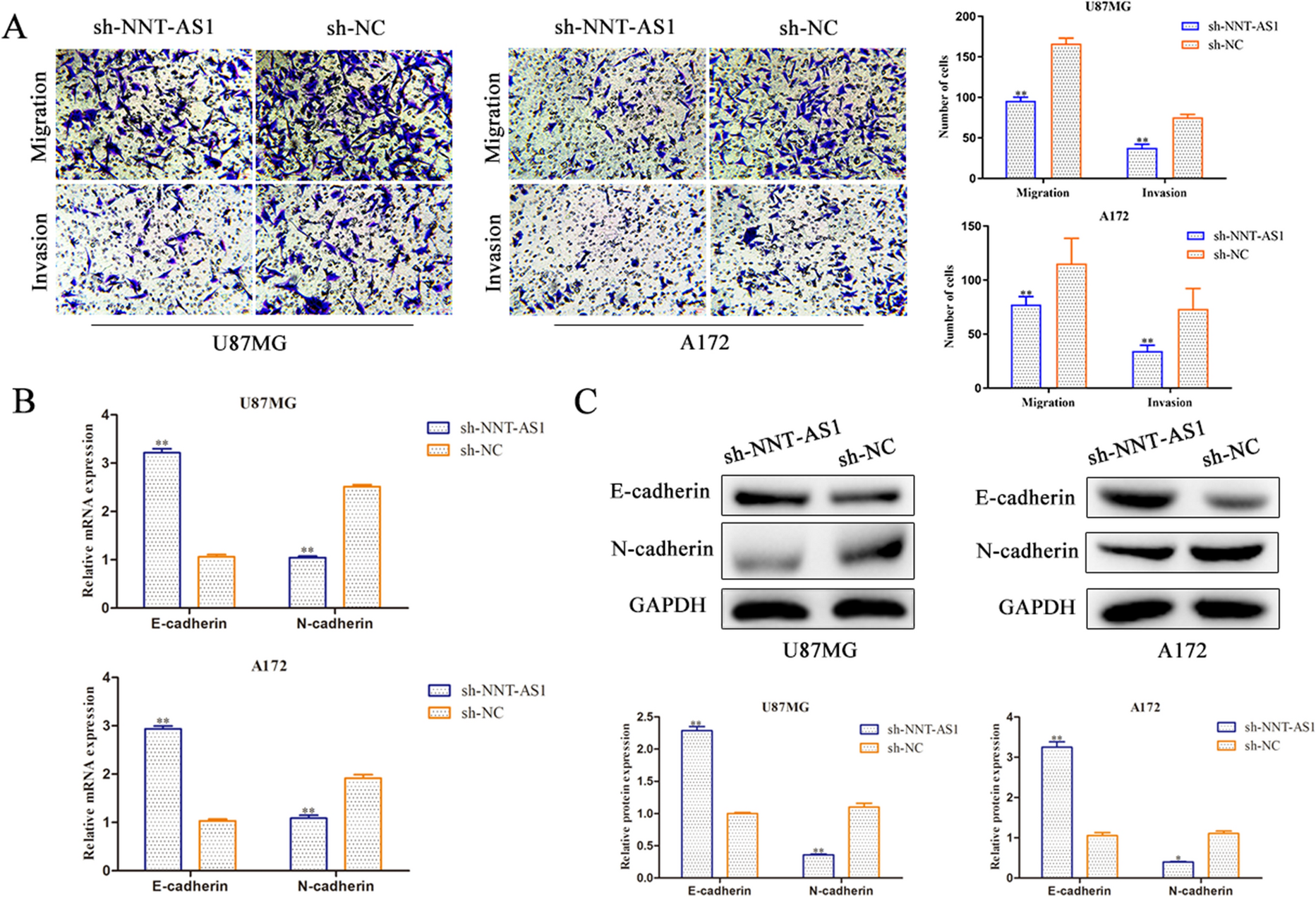 Correction: LncRNA-NNT-AS1 contributes to the progression of glioma by miR-582-5p/EZH2 axis