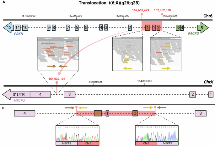 Unraveling MECP2 structural variants in previously elusive Rett syndrome cases through IGV interpretation
