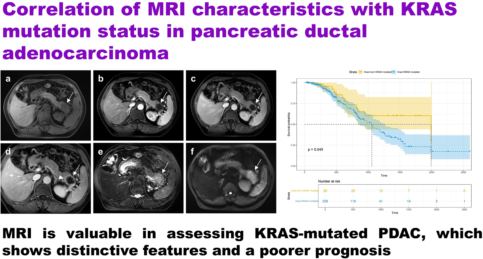 Correlation of MRI characteristics with KRAS mutation status in pancreatic ductal adenocarcinoma