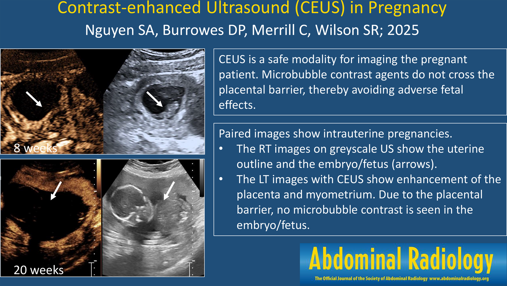 Contrast-enhanced ultrasound in pregnancy