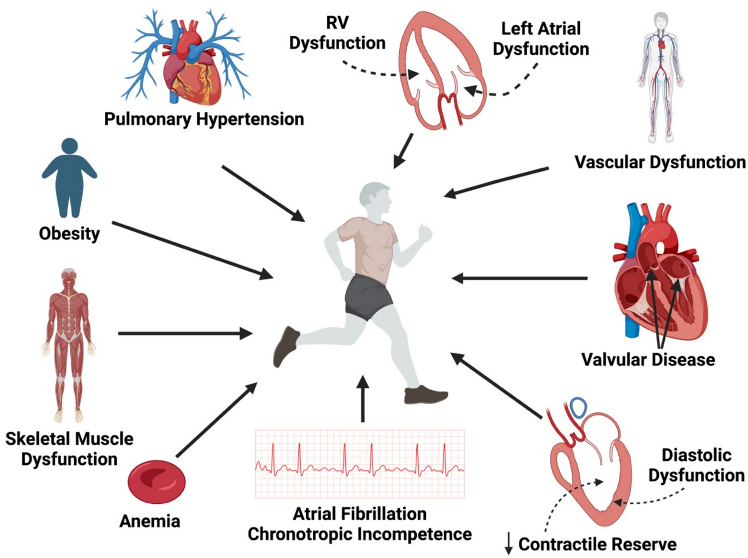 Mechanisms of exercise intolerance in heart failure with preserved ejection fraction (HFpEF)