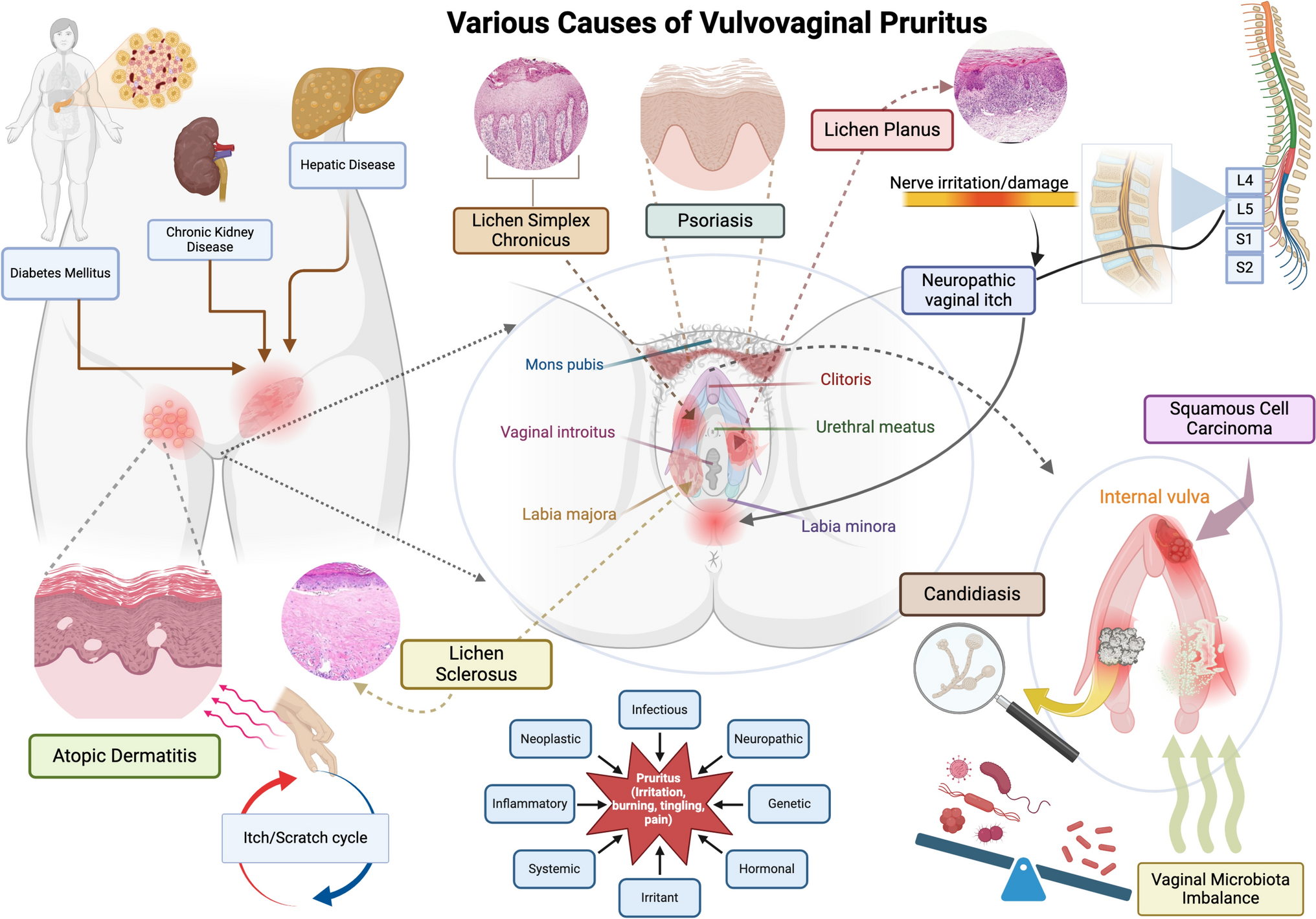 Scratching the Surface: A Comprehensive Guide to Understanding and Managing Vulvovaginal Itching