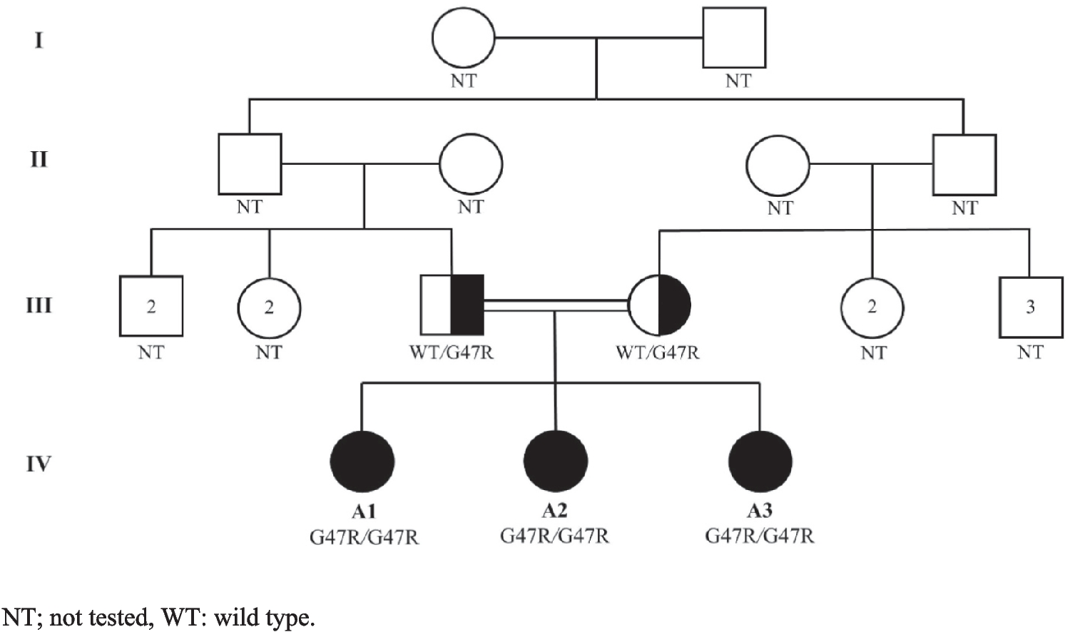 Deficiency of Adenosine Deaminase 2 Masquerading as Behçet’s Disease: Phenotypic Mimicry with HLA-B*51 Positivity