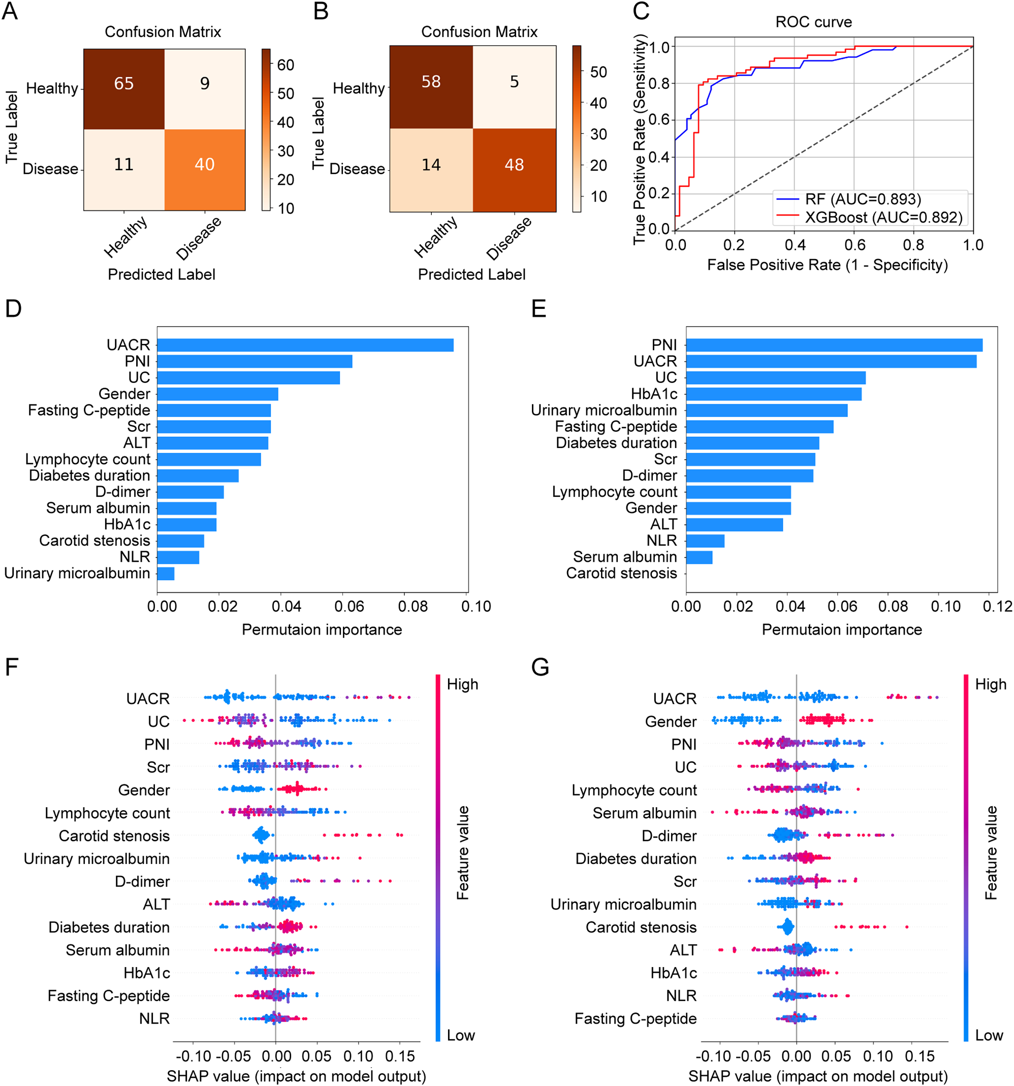 Prognostic nutritional index and diabetic peripheral neuropathy in type 2 diabetes: a machine learning approach