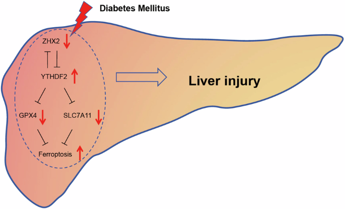 ZHX2 inhibits diabetes-induced liver injury and ferroptosis by epigenetic silence of YTHDF2