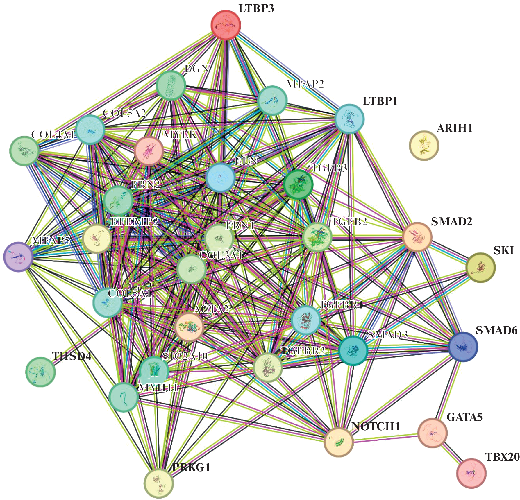 Pathogenetic Potential of the Epigenetic Status of Genes of Mendelian Forms of Thoracic Aortic Aneurysms