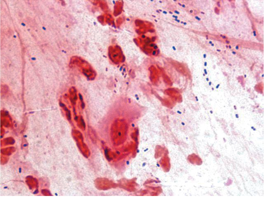 Peculiarities of General and Mucosal Immunity in Urban Residents of Murmansk Oblast