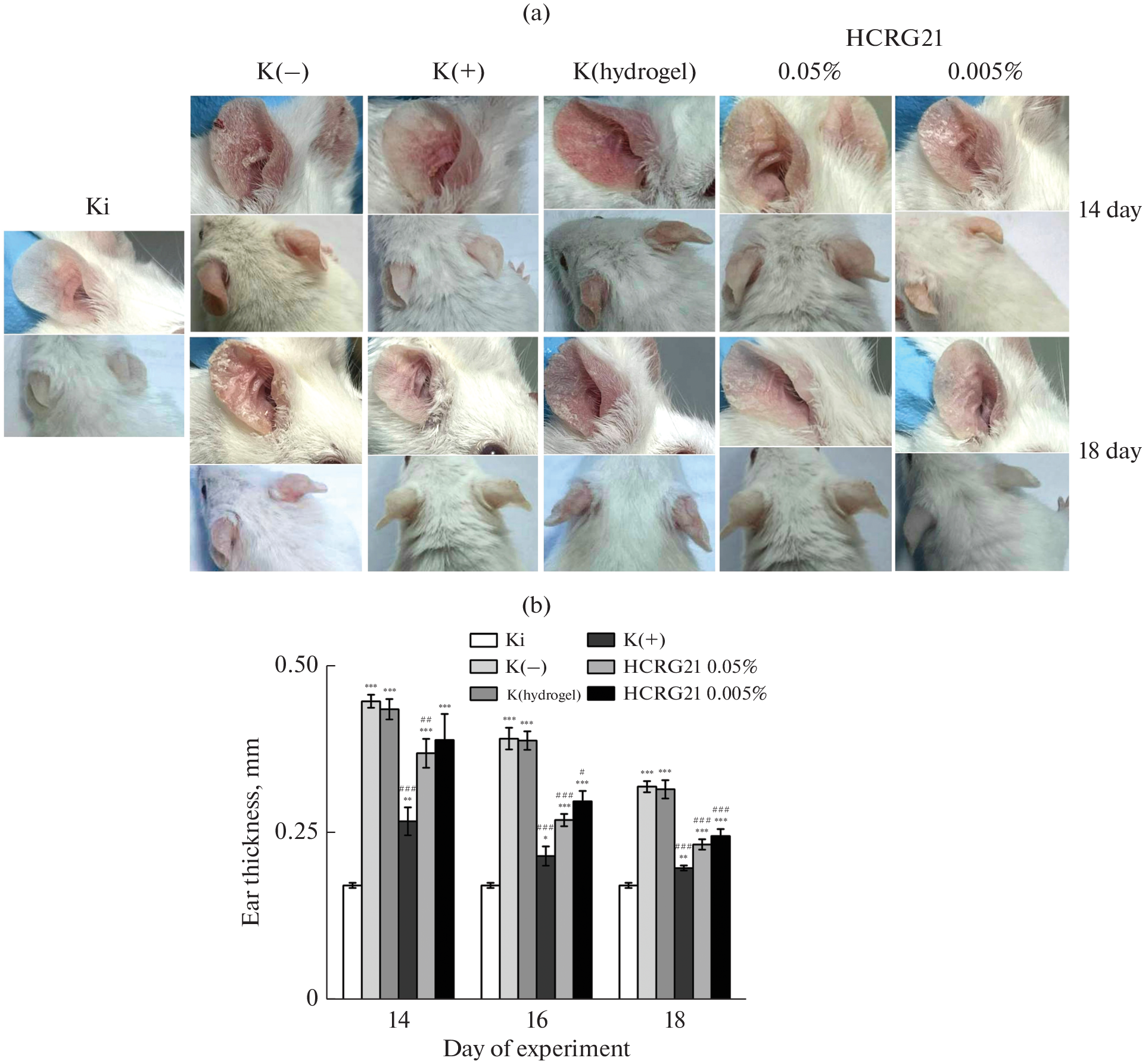 Peptide TRPV1 Channel Blocker, HCRG21, Effectively Suppresses Inflammation in a Calcipotriol-Induced Allergic Dermatitis Model