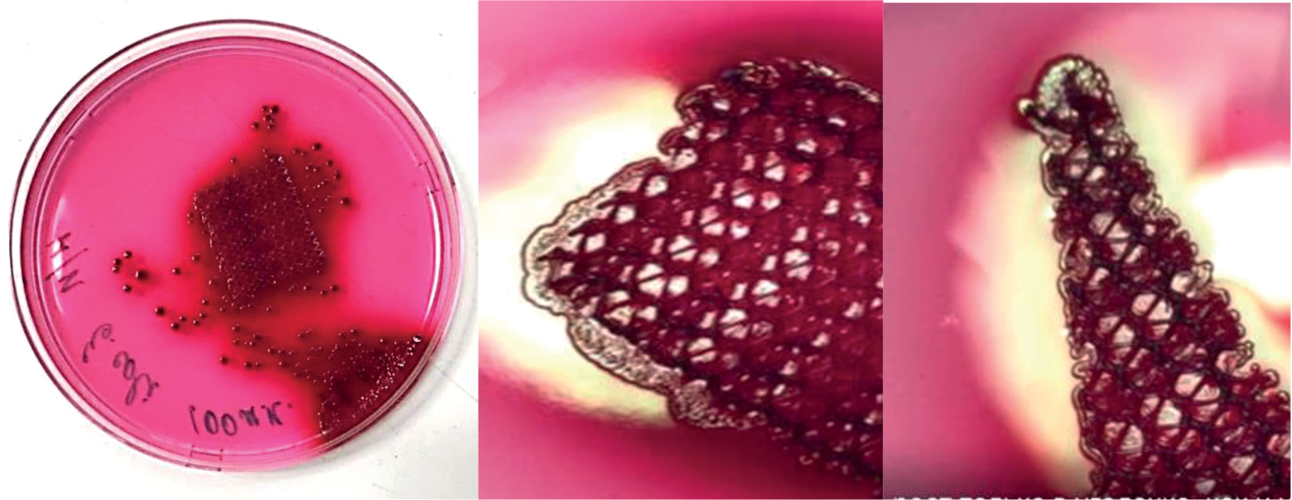 Improving the Functional and Antibacterial Properties of an Endoprosthetic Mesh Using Atomic Layer Deposition Technology