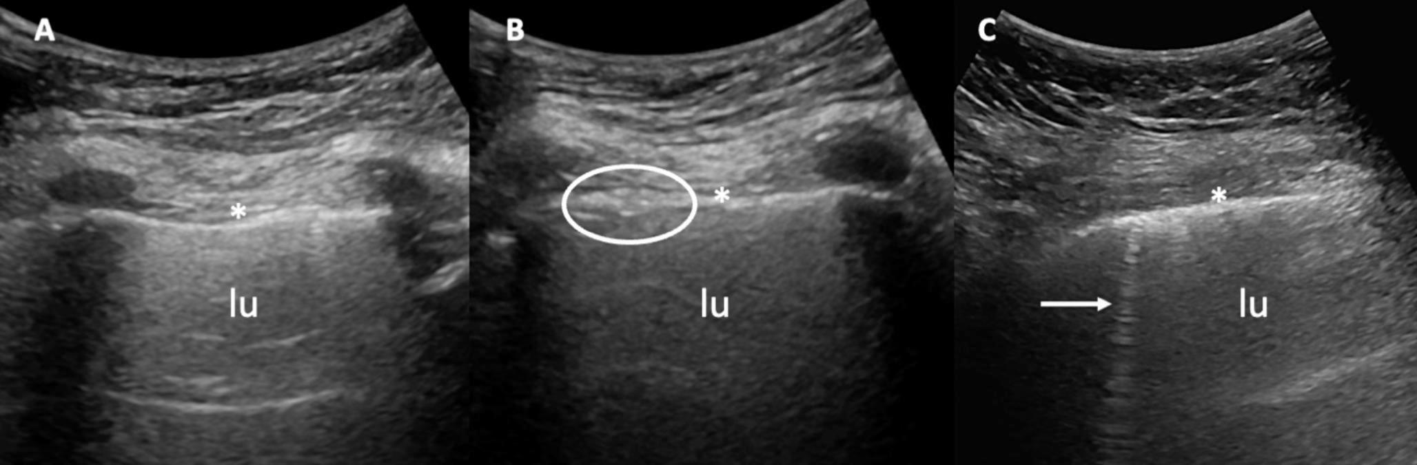 Ultrasound Beyond Joints: A Review of Extra-Articular Applications in Rheumatology