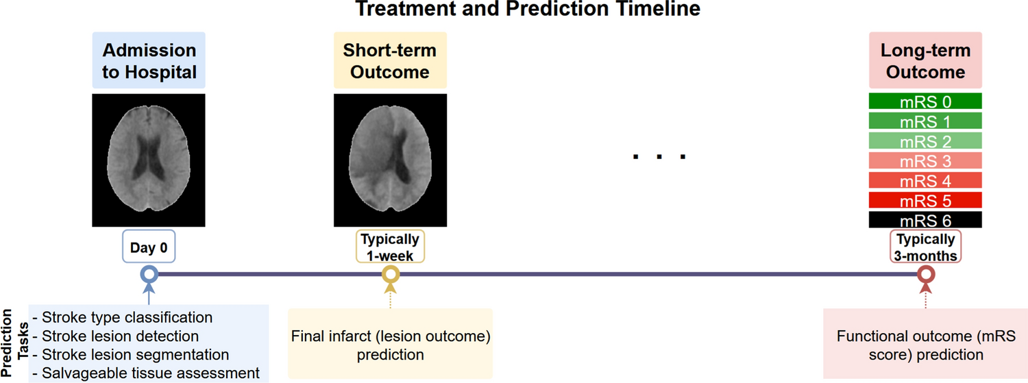 Automatic prediction of stroke treatment outcomes: latest advances and perspectives