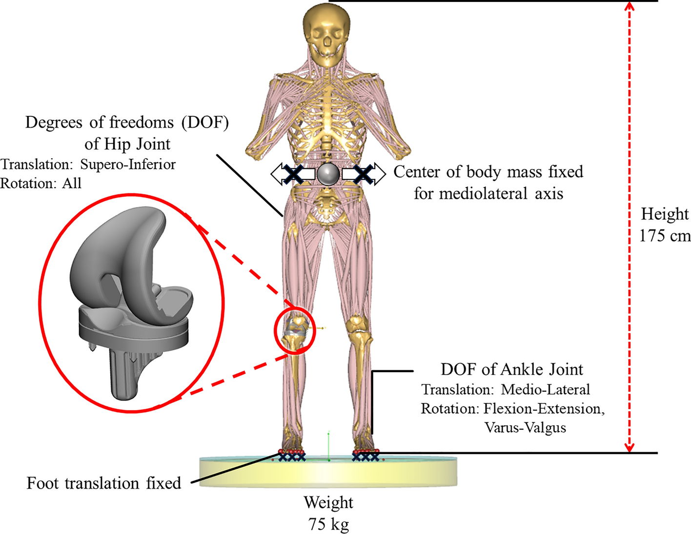 Impacts of medial collateral ligament (MCL) stiffness adjustment on knee joint mechanics in mechanically aligned posterior-substituting (PS) total knee arthroplasty (TKA)