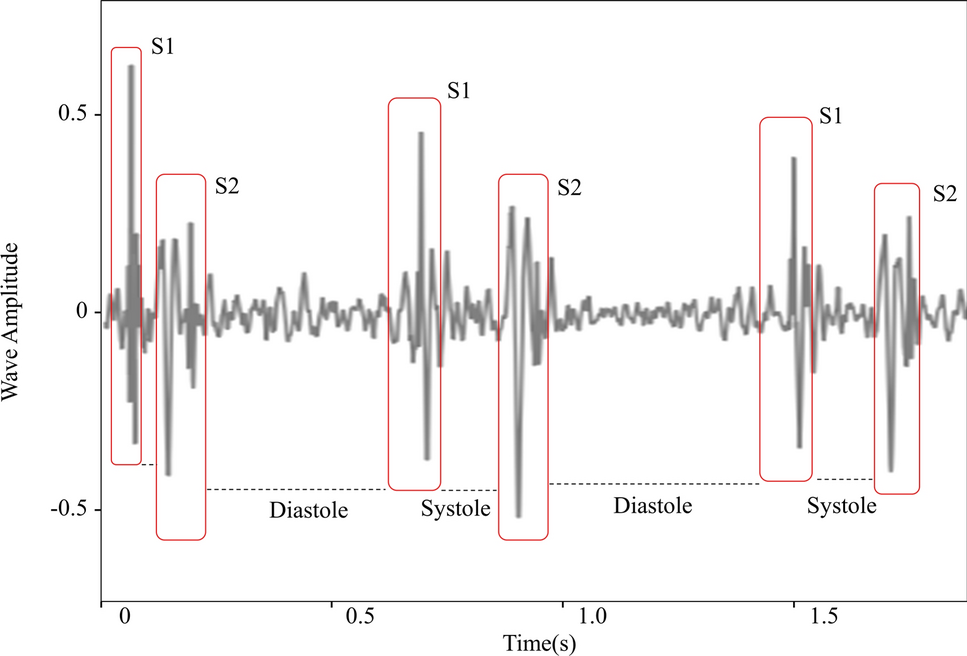 Enhancement of phonocardiogram segmentation using convolutional neural networks with Fourier transform module