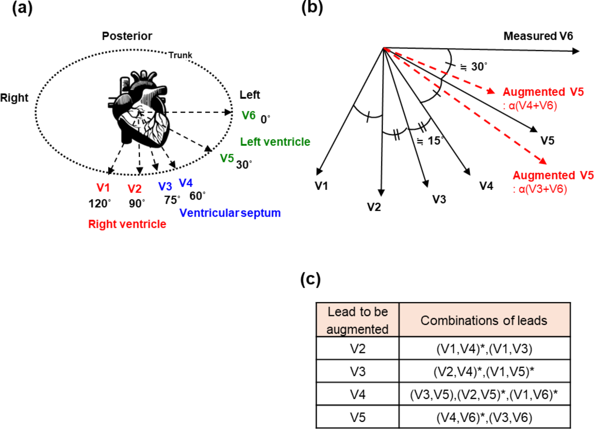 Specialized ECG data augmentation method: leveraging precordial lead positional variability