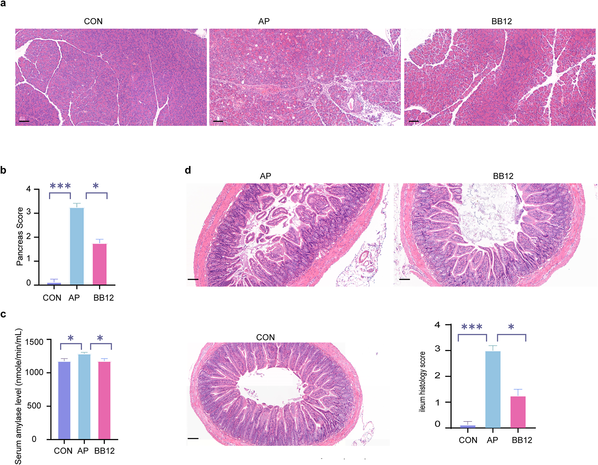 Role of Bifidobacterium animalis subsp. lactis BB-12 in mice with acute pancreatitis