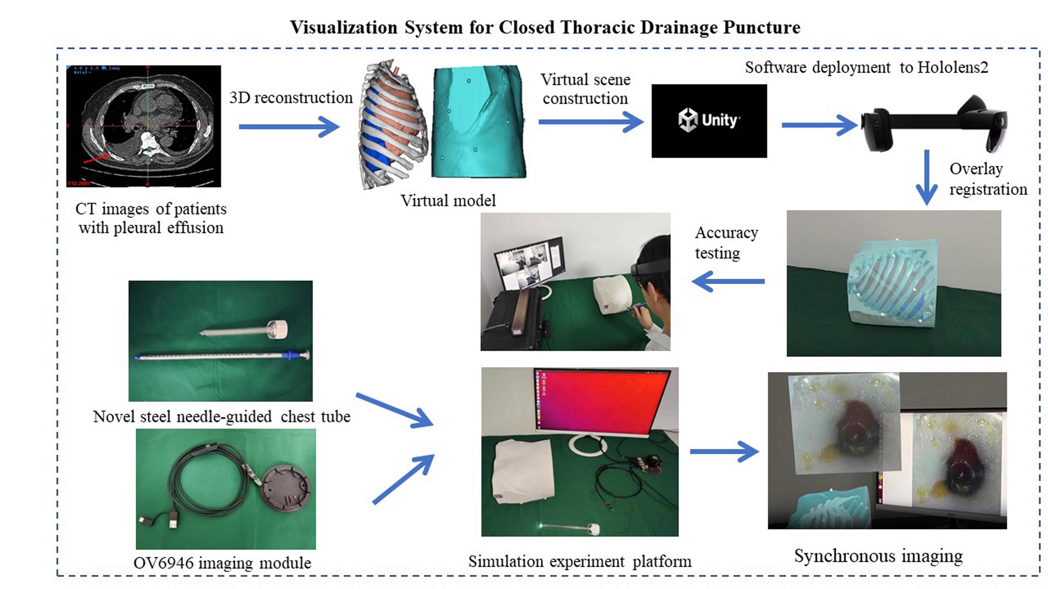 Visualization System for Closed Thoracic Drainage Puncture Based on Augmented Reality and Ultrafine Diameter Camera