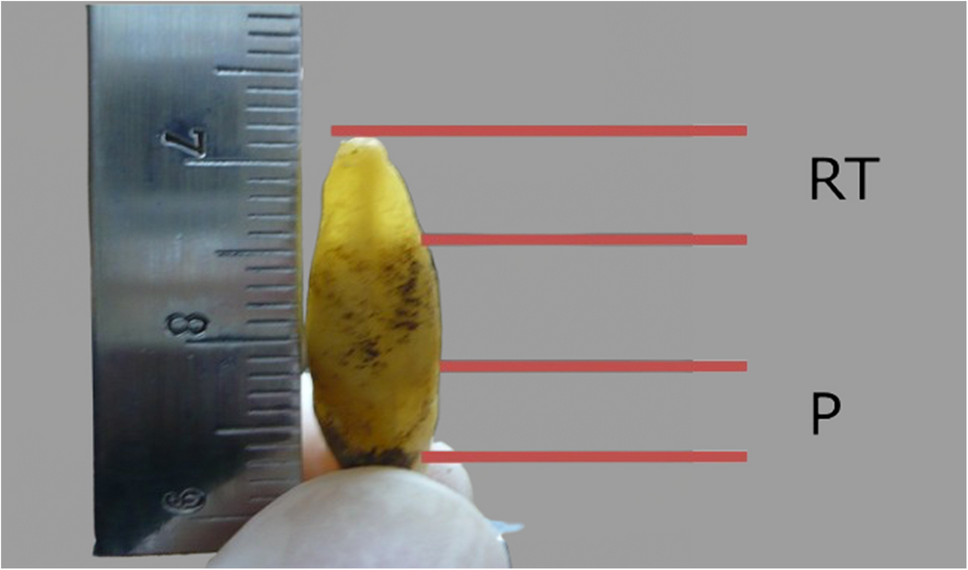 Evaluating the accuracy of root transparency and periodontosis age estimation models in a Portuguese population