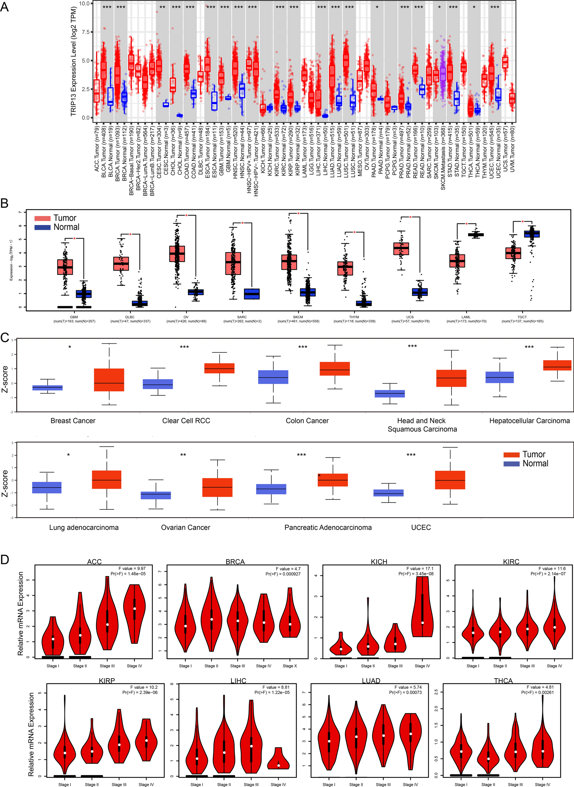 Thyroid hormone receptor interacting protein 13 is associated with prognosis and immunotherapy efficacy in human cancers: a pan-cancer analysis