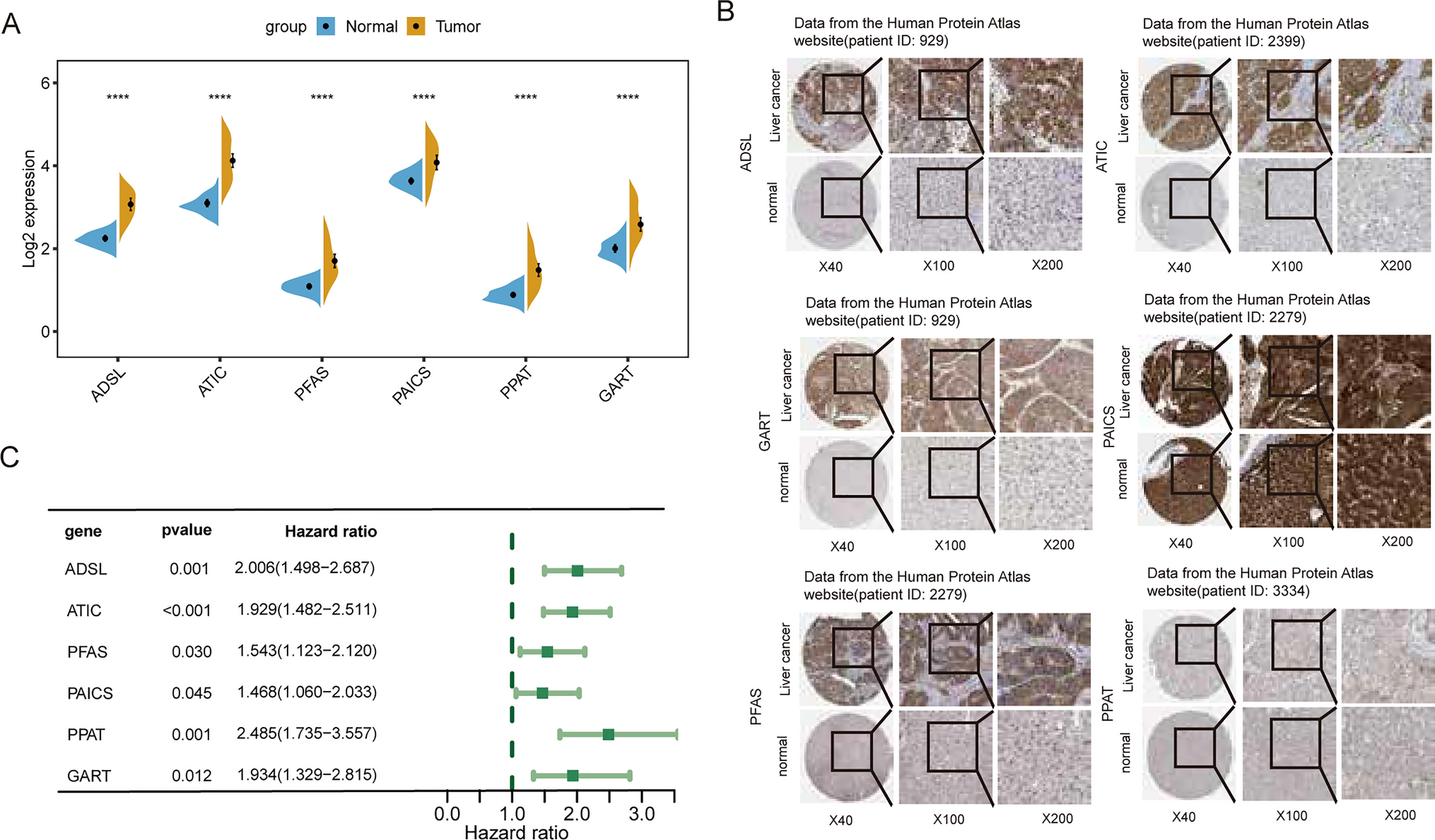 Purinosomes as a therapeutic target in hepatocellular carcinoma: insights and opportunities
