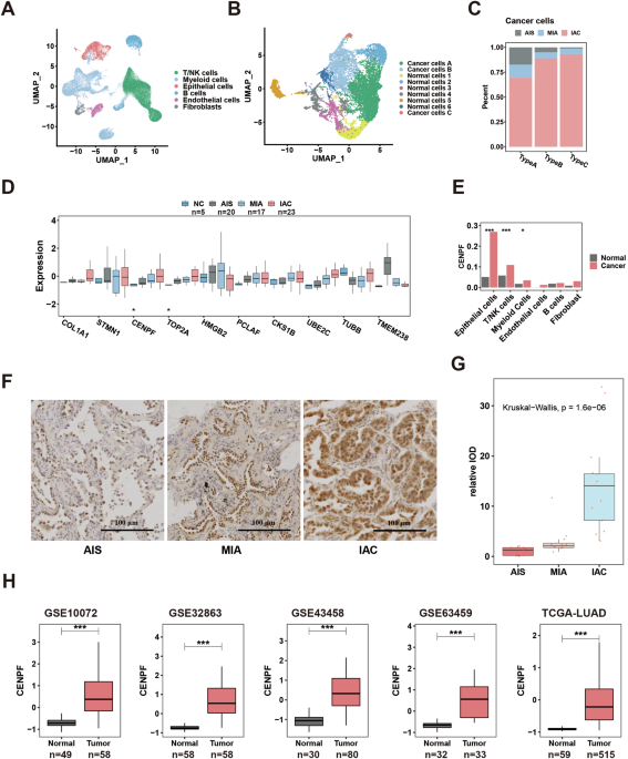CENPF (+) cancer cells promote malignant progression of early-stage TP53 mutant lung adenocarcinoma